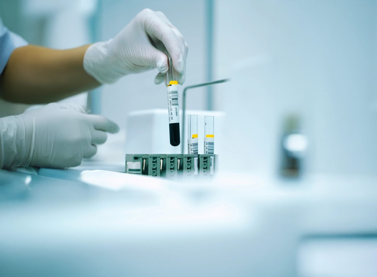 Genetikai laboratóriumi tesztelés vérmintával